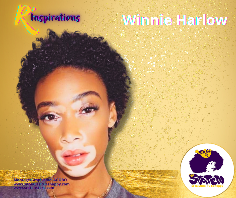 Winnie Harlow