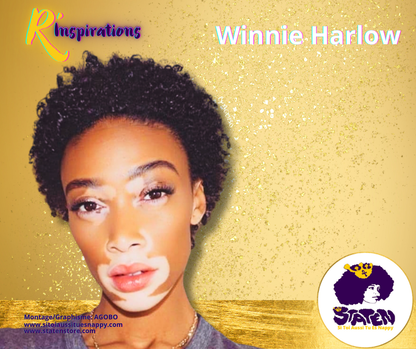 Winnie Harlow