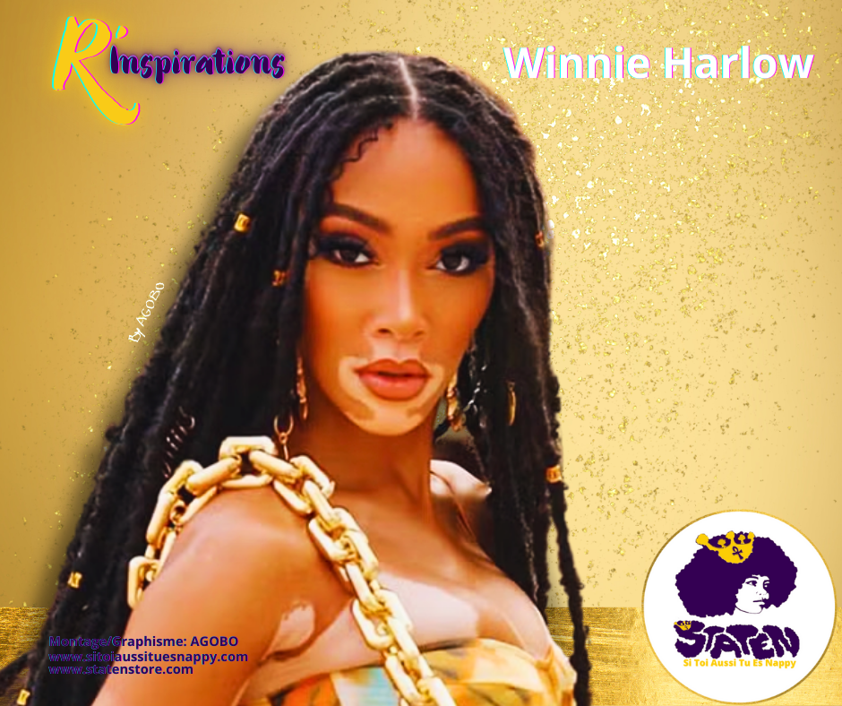 Winnie Harlow