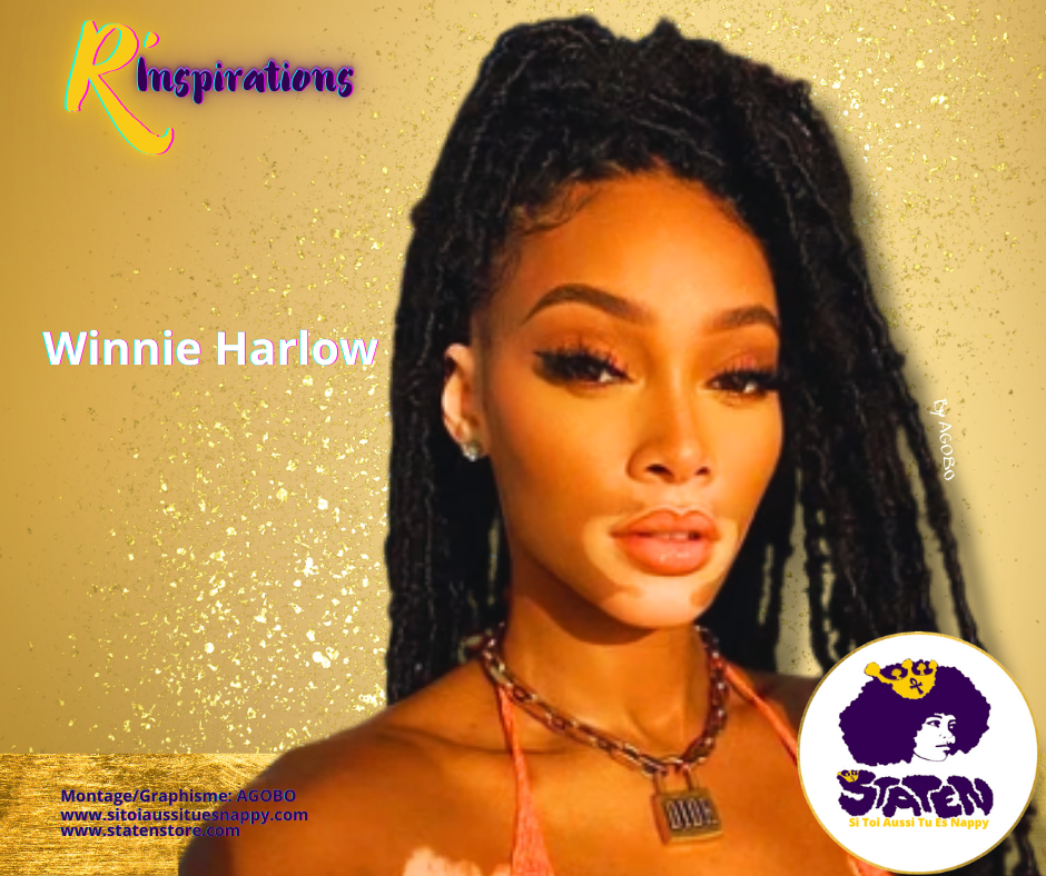 Winnie Harlow
