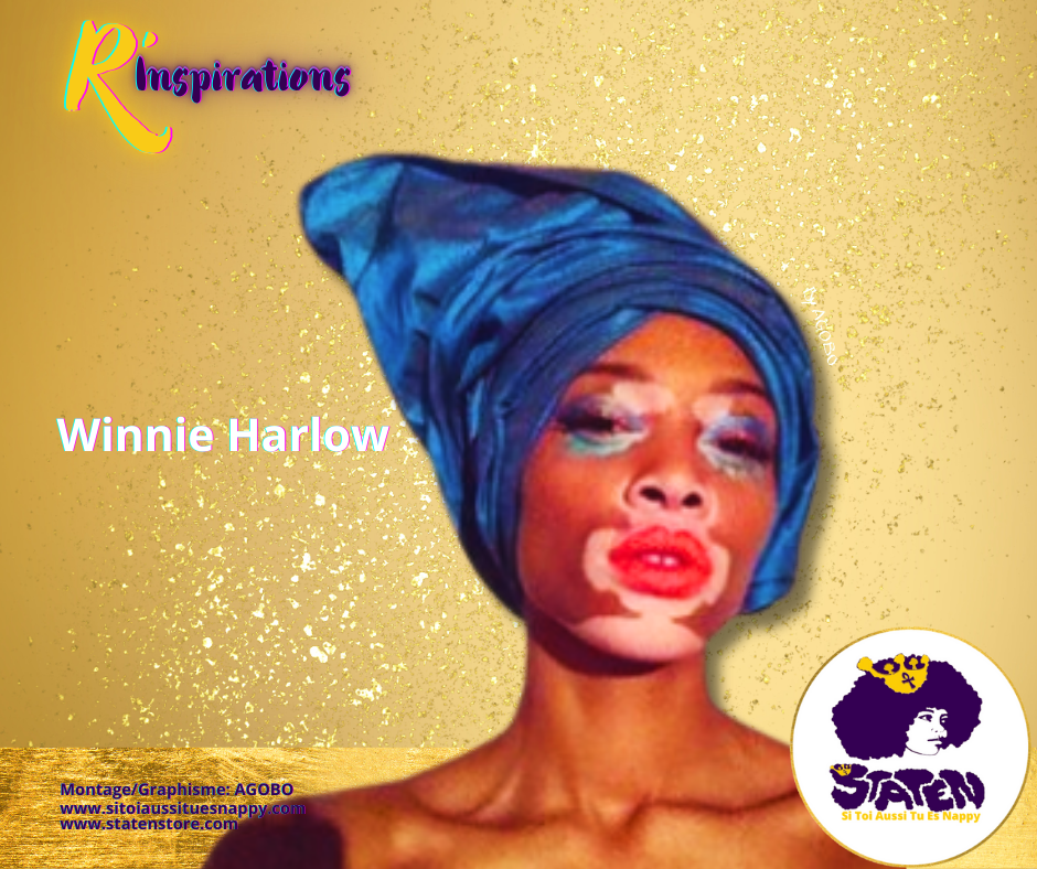 Winnie Harlow